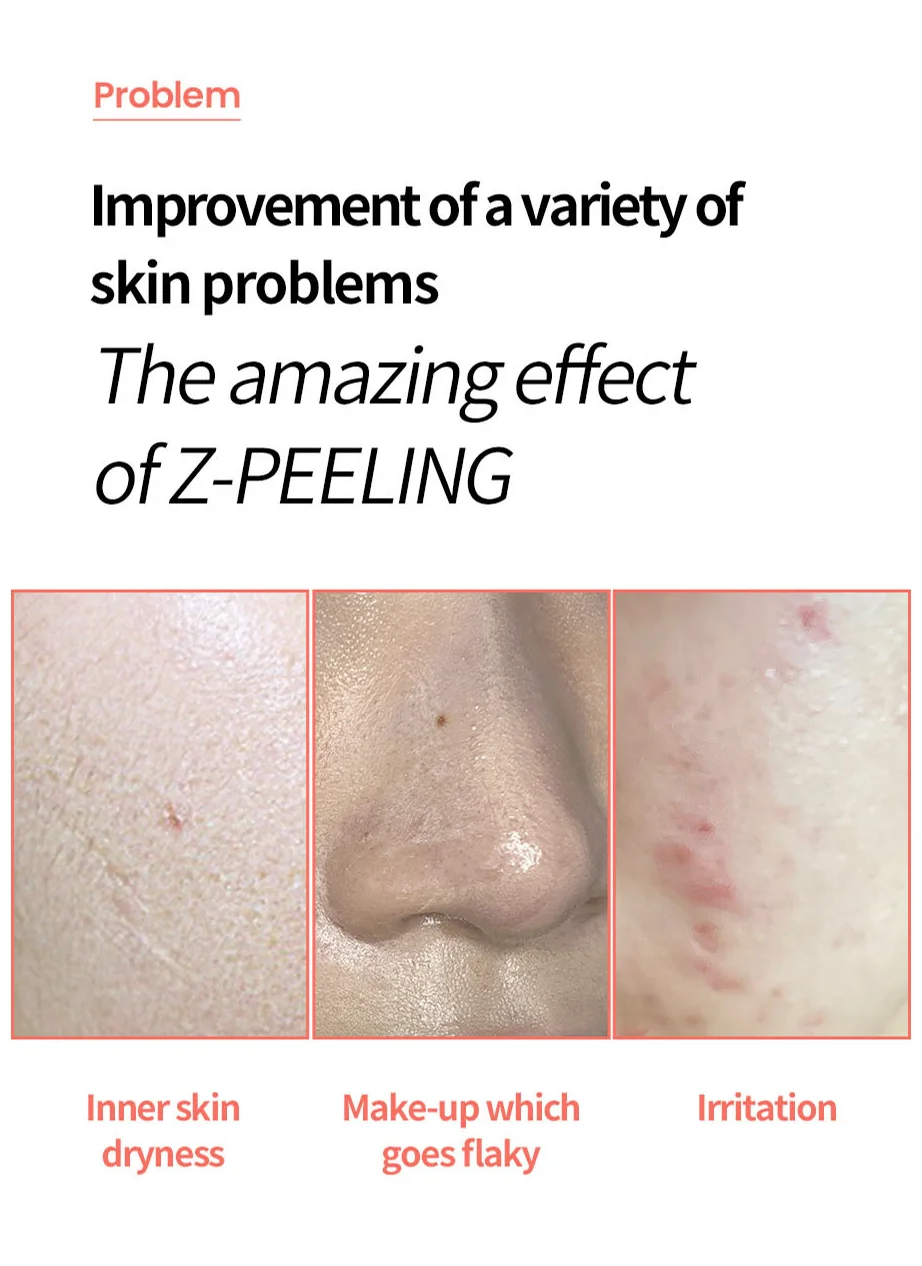 FACE FACTORY GALVANIC Z WATERPEELING MACHINE [Made in Korea/Beauty & Personal Care/USFDA/OEM/ODM/Beauty Device]