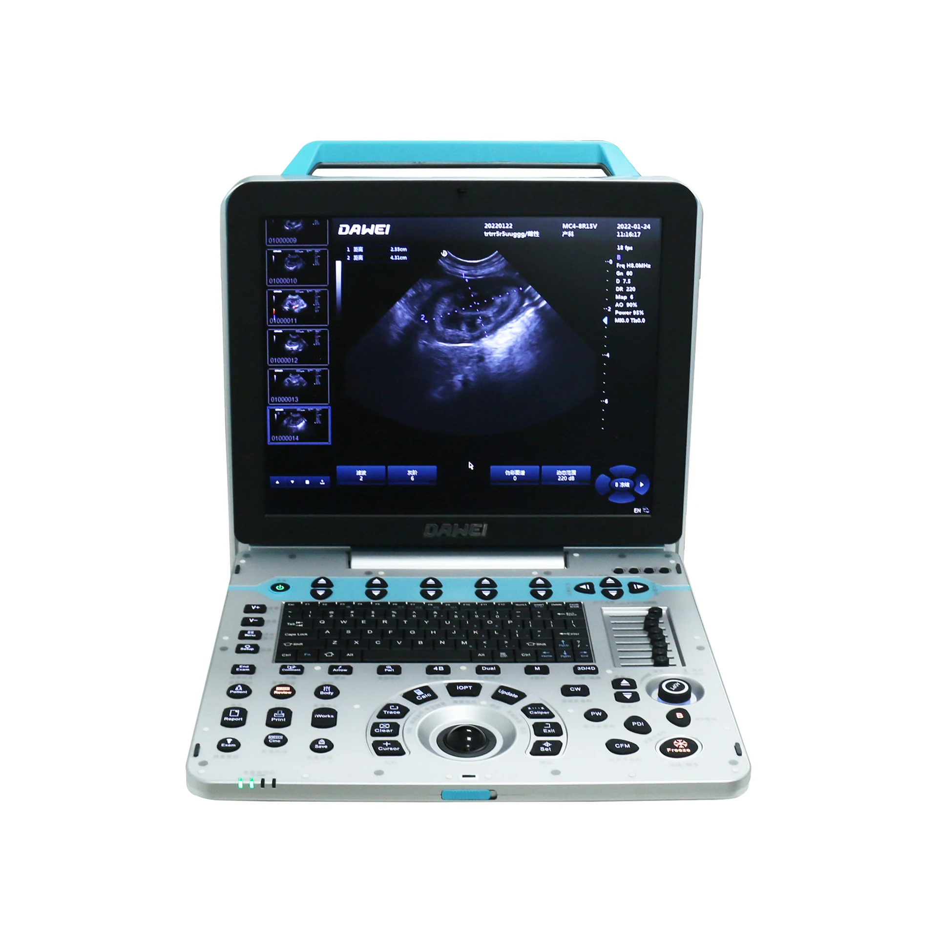 Dawei Vet Ultrasound Scanner Veterinary Digital Ultrasound Machine Companion Animal Color Doppler Ultrasound