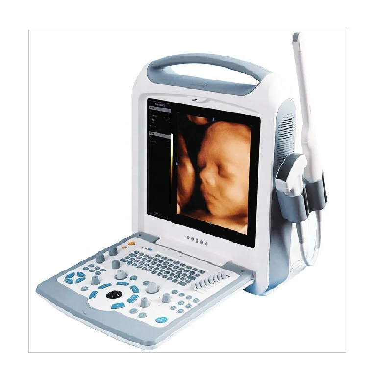 High Accuracy Factory price   CE Approved  medical  Ultrasound Scanner