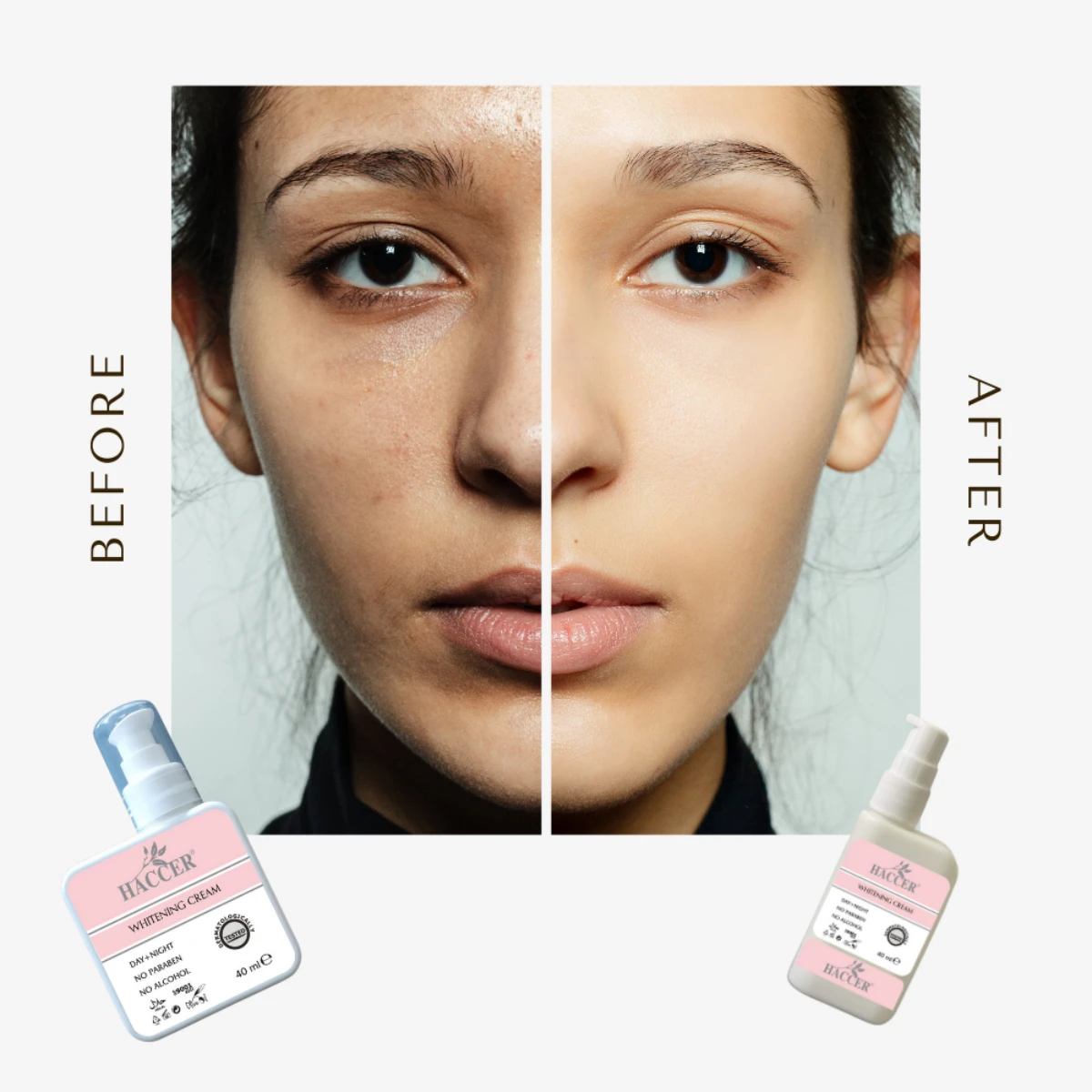 25% Перманентная белизна за 9 дней, отбеливающий крем для лица, индивидуальная марка, для подмышек, всего тела, интимное, сделано в Турции