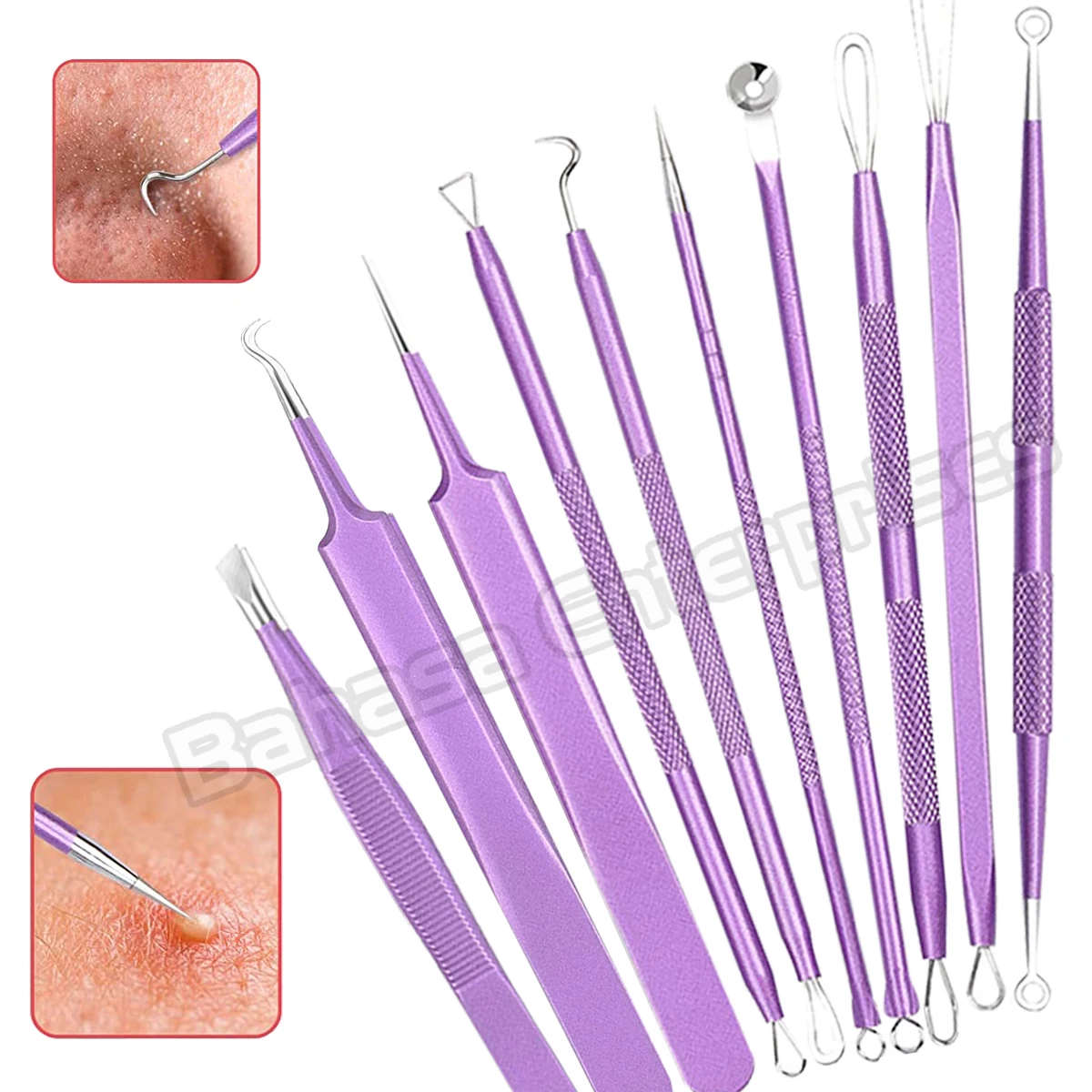 Stainless Steel Blackhead Removal Kit 10Pcs Blemish Pimple Extractor Remover Cosmetic Face Cleaning Tool