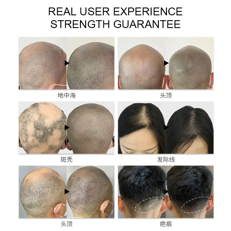 [Dark Brown] SMP  Pigment  Hairline Crown Scalp Head Micropigmentation Machine New product  SMP organic