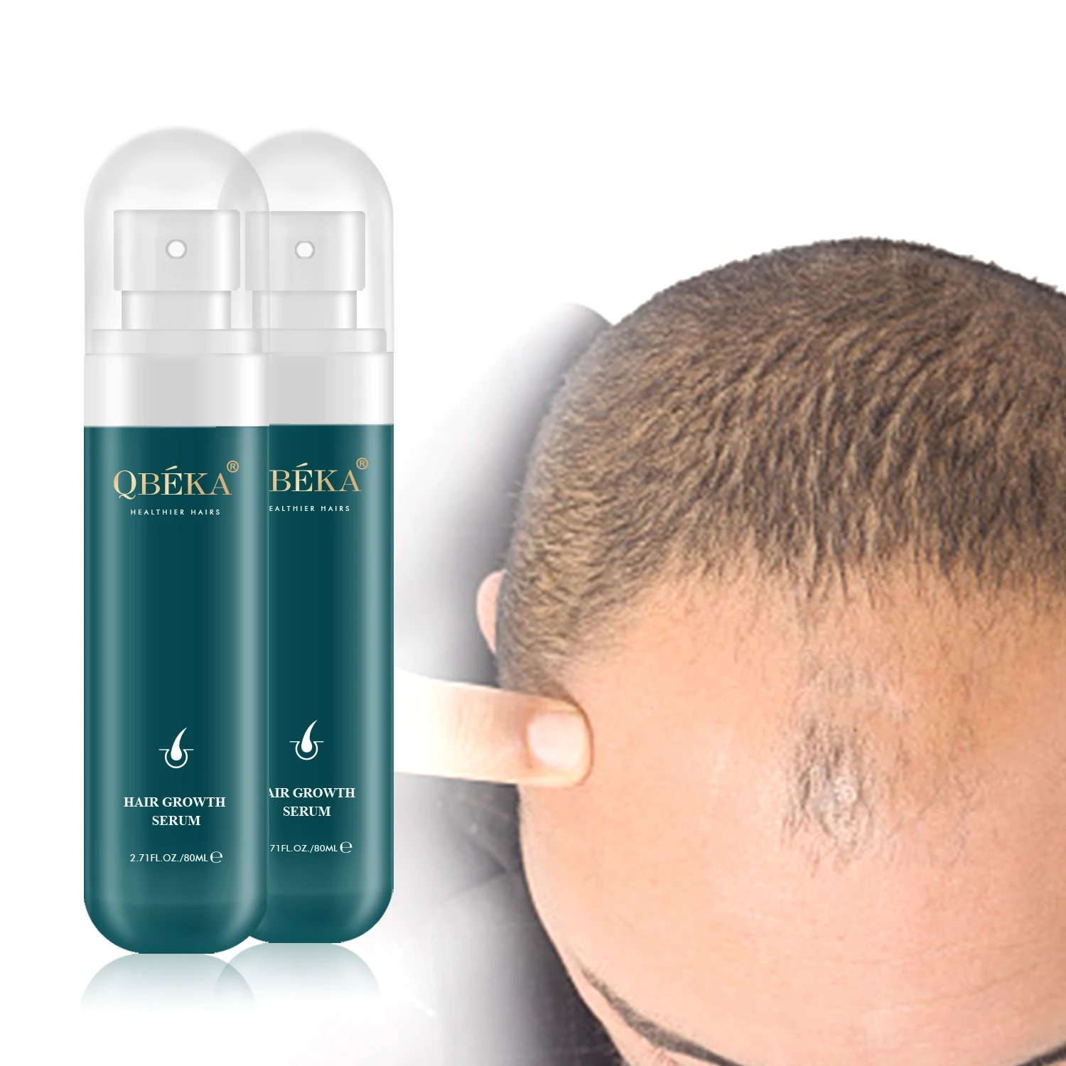Anti Loss Serum Hair Growth Oil Alopecia Hair Loss for Enhance Hair Grows