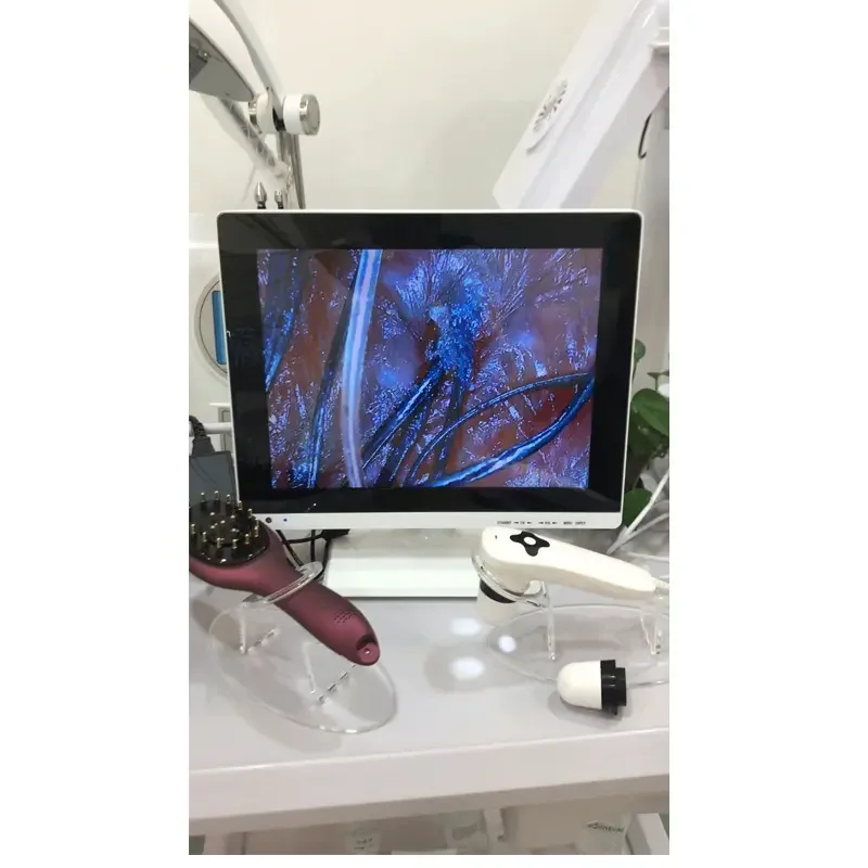 4 Windows Laptop Type Skin Analyzer And Hair Scalp Follicle Enlarge Analysis Machine With Two Camera