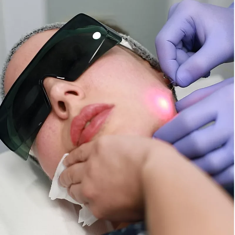 Diode Laser Vaser Lipo Equipment Cold Lipolysis Liposuction Belly Fat Reducing Device Slimming Machine