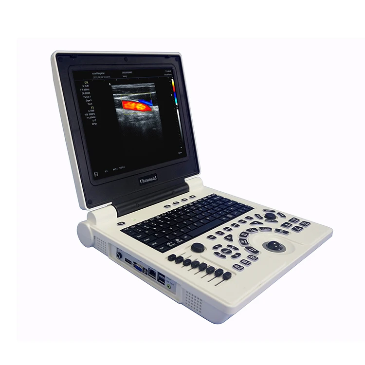 Cheapest 3D Laptop Color Doppler Ultrasound Diagnostic System  Machine for Hospital