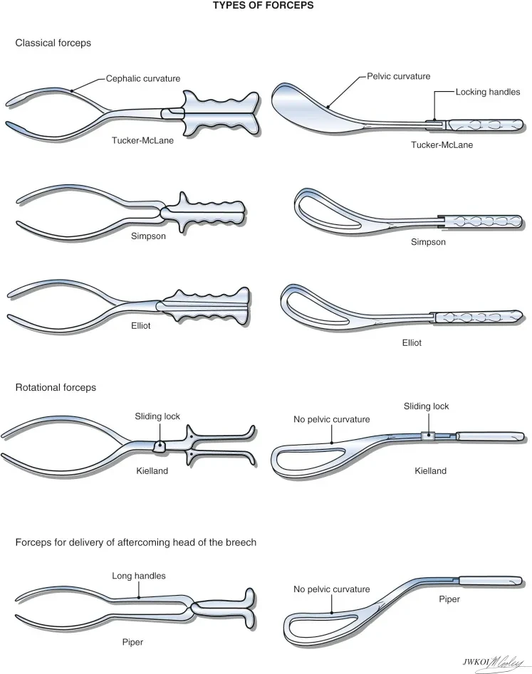 Delivery Forceps 30cm Stainless Steel Piper Obstetrical Forceps Gynecology Surgical Fine Gynae Normal Delivery Instruments