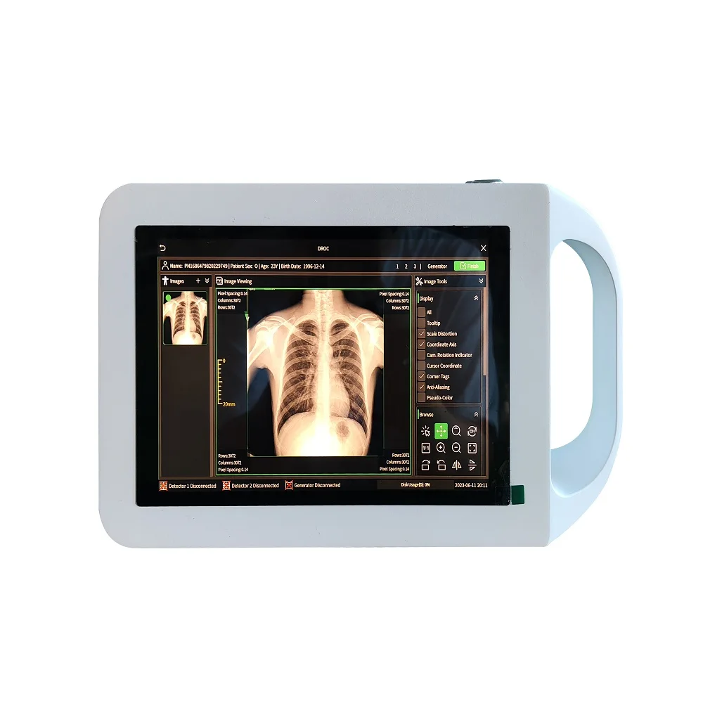 The x-ray portable digital x-ray machine use unique DROC software  and wireless WIFI MSLGX26.