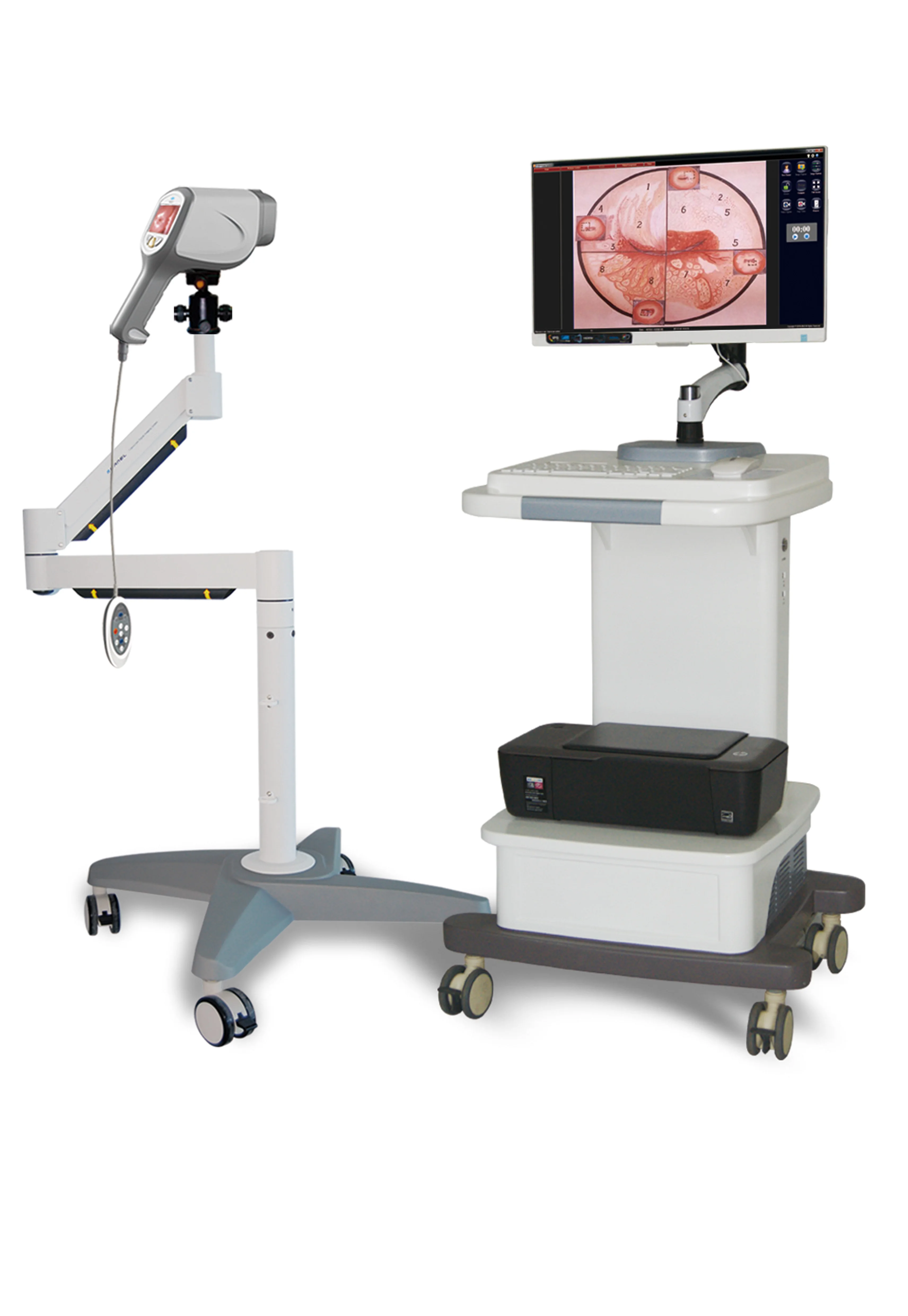 Hot Selling Clinical Portable Handheld Colposcopy Machine Video Camera Portable Optical ColposcopeSIN-CE07