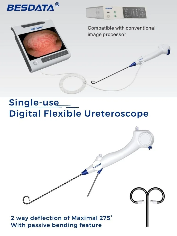 chinese portable Disposable Urology abdeckung bladder Surgical Instruments equipment Endoscopy System Flexible Ureteroscope