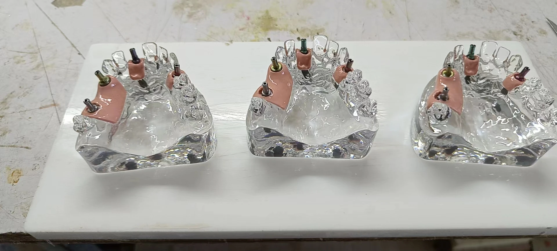 customize teeth model