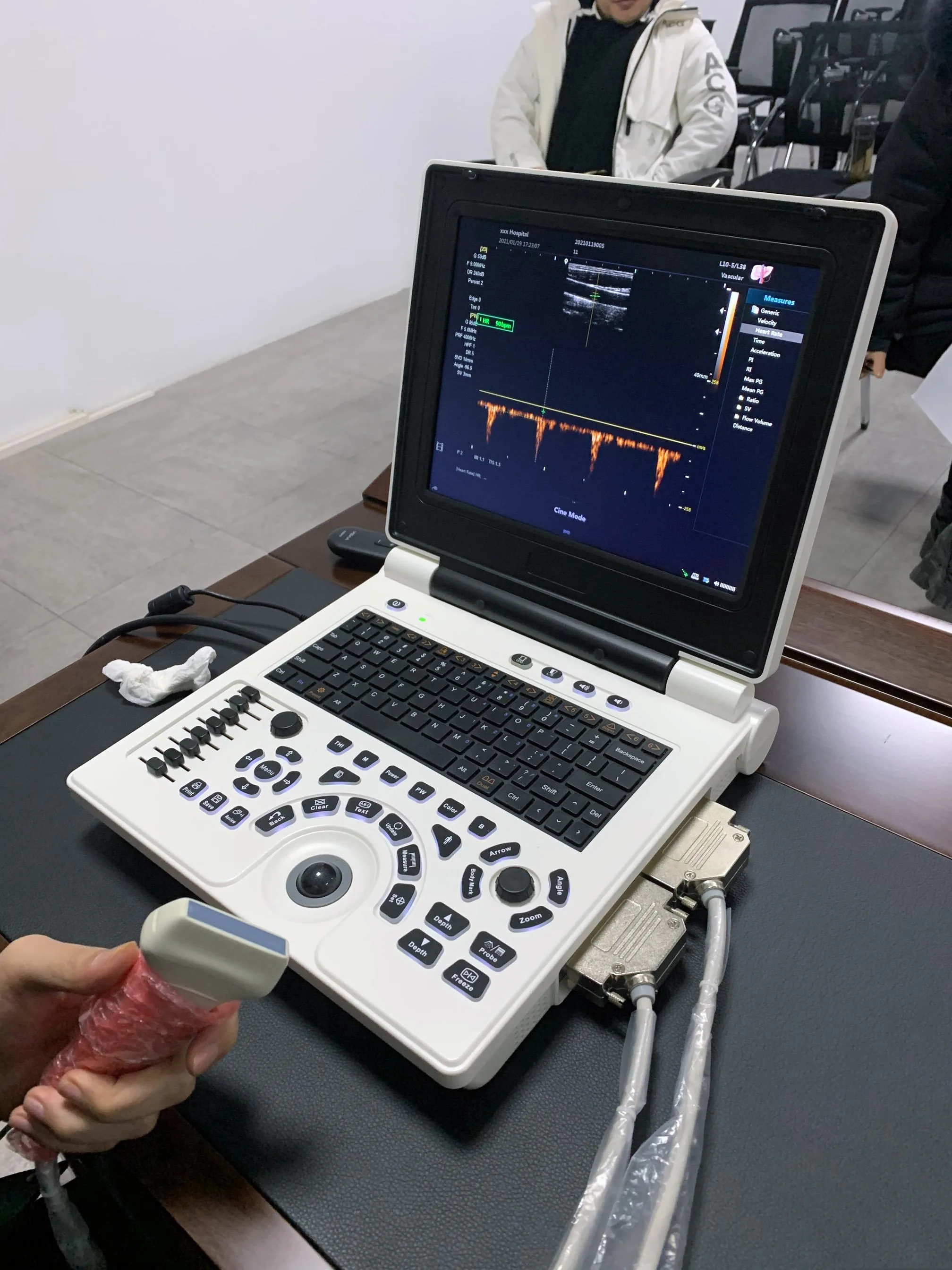 Cheapest 3D Laptop Color Doppler Ultrasound Diagnostic System  Machine for Hospital