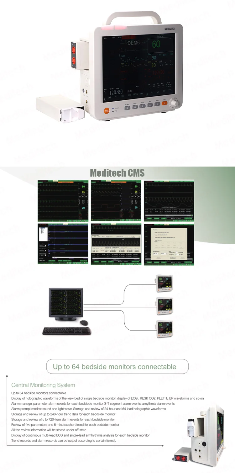 Meditech 12 inch touch screen modular patient monitor For ICU