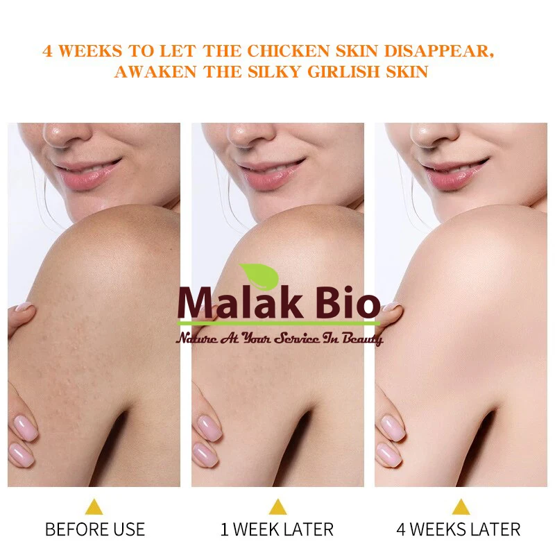 body lotion benefits