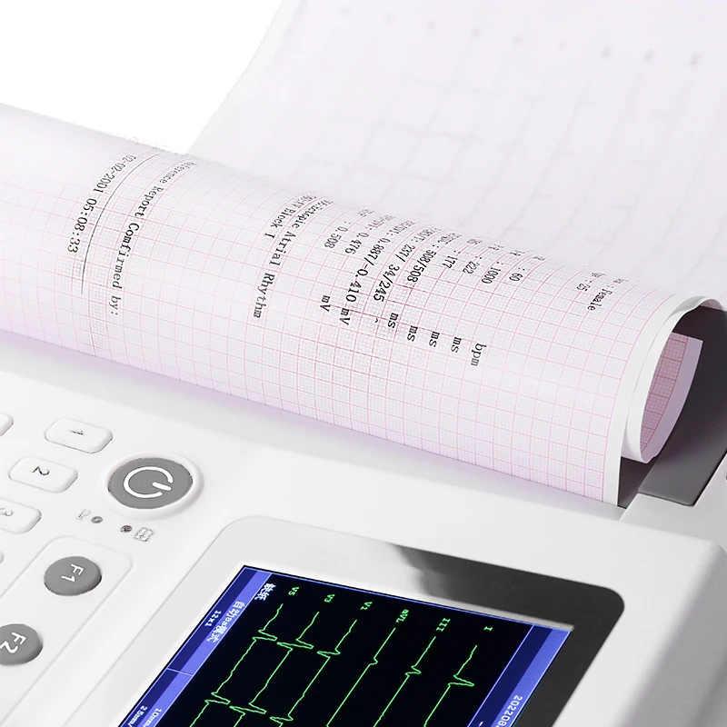 Авто-анализ авто-интерпретация беспроводной цифровой электрокардиограф ЭКГ 12 каналов ISO сертифицированный