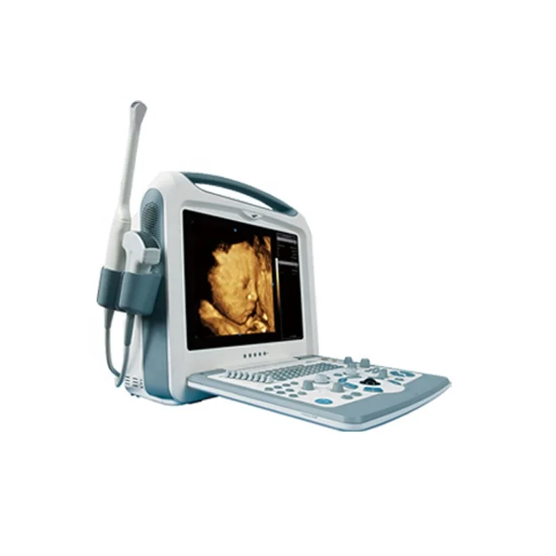 High Accuracy Factory price   CE Approved  medical  Ultrasound Scanner