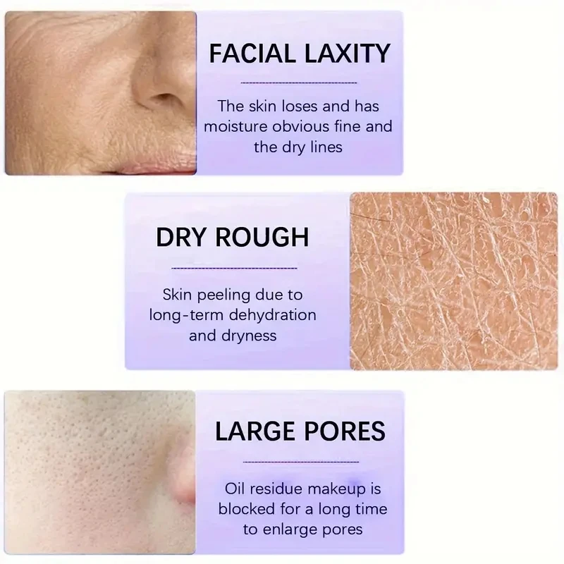 Customize Skin Renewing Hydrating Hyaluronic Acid Retinol Resurfacing Face Serum Reduce Fine Lines Wrinkles Protect Barrier