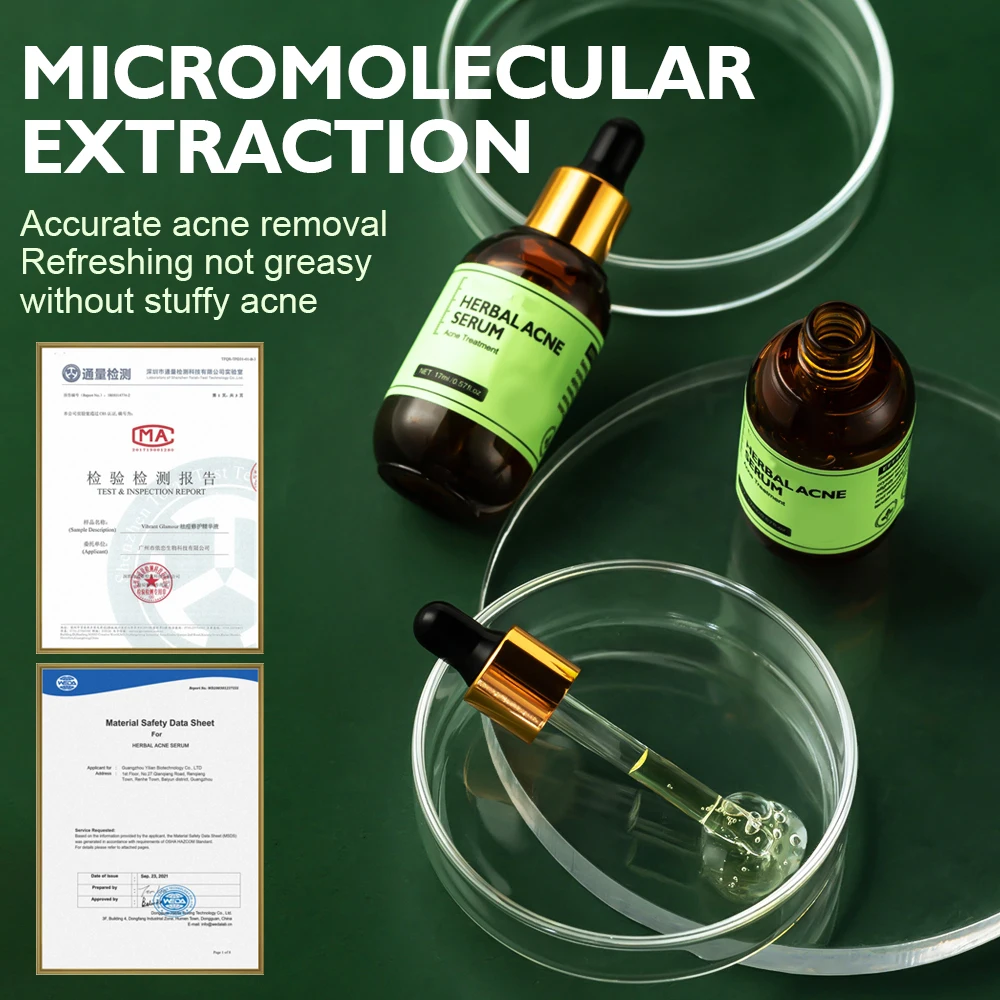 Acne Treatment Serum Private Label Acne Spot Serum Treatment Skin Care Acne Treatment Face Serum