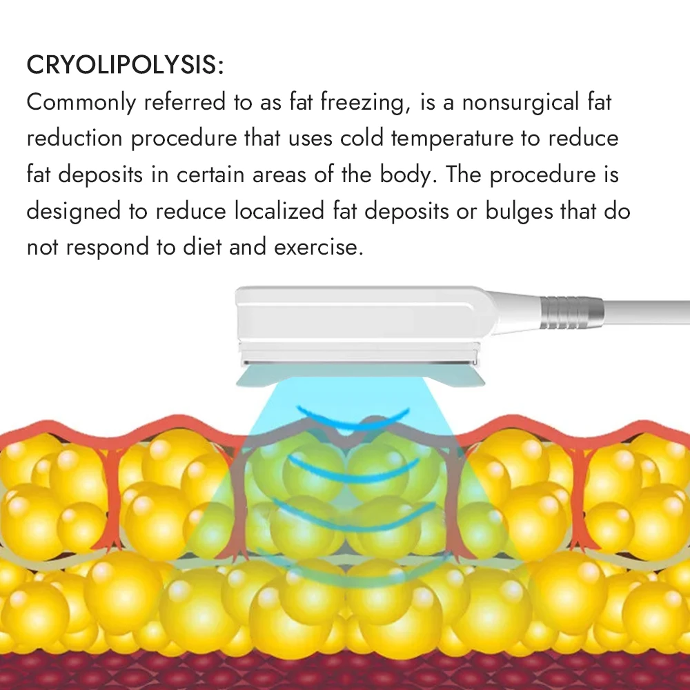 Synogal manufacturer price 360 cryo lipo suction sculpting fat loss cryolipolysis slimming machine