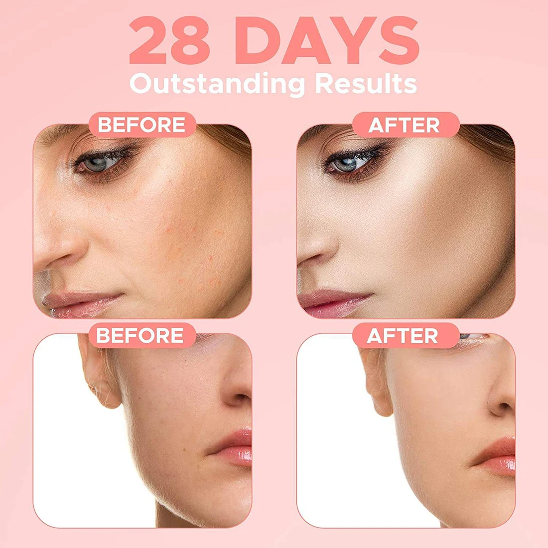 New Skin Care Serum Facial 4 in 1 Whitening Anti Age Face Serum with 30% Vitamin C 5% Niacinamide 10% Vitamin E Serum