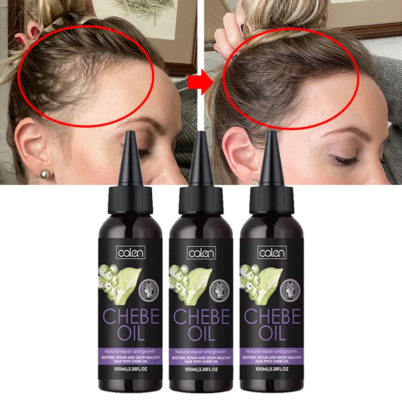 Oalen Private Label Hair Repairing Chebe Product 100% Chebe Powder And Karkar Oil Chebe Oil Gallon