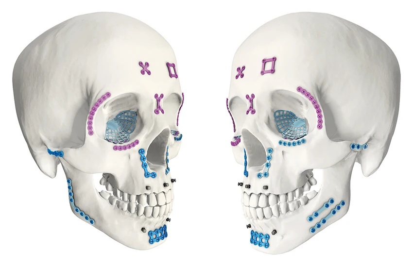 Titanium Carnio Maxillofacial Mini Micro Cortical Screws 5mm 6mm 8mm 10mm 12mm Cross Slot Self Tapping / Cutting Tools