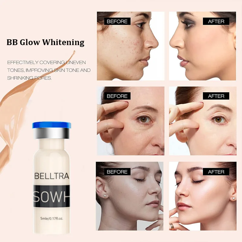 Whitening cream  korean derma pen serum kit 8ml x 12 vials stayve bb cream glow white meso serum foundation skin booster kit