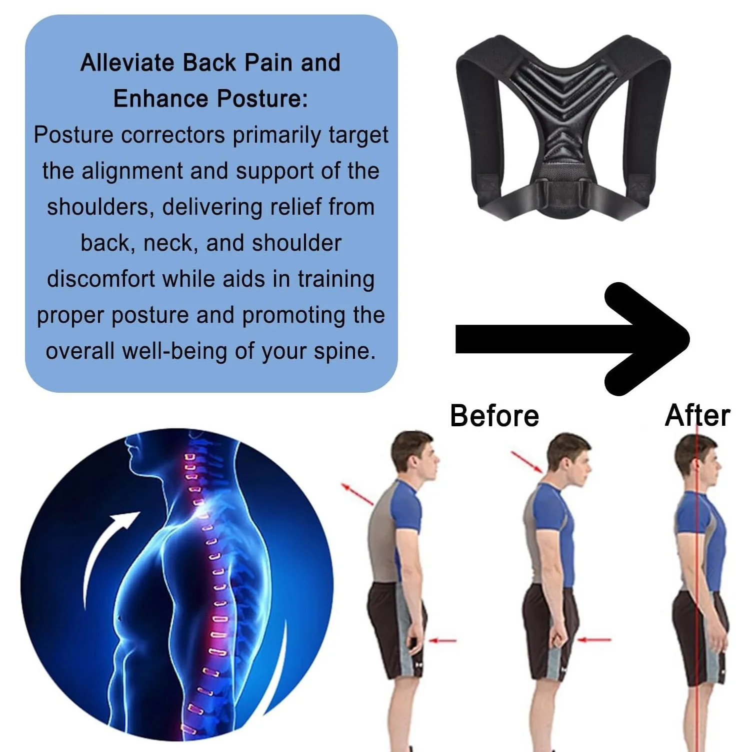 Posture Corrector for Women and Men, Vicorrect Adjustable Upper Back Brace for Clavicle Support