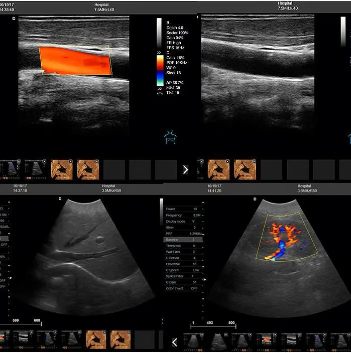 Usg machine 4d  3d ultrasound machine digital portable doppler ultrasound price