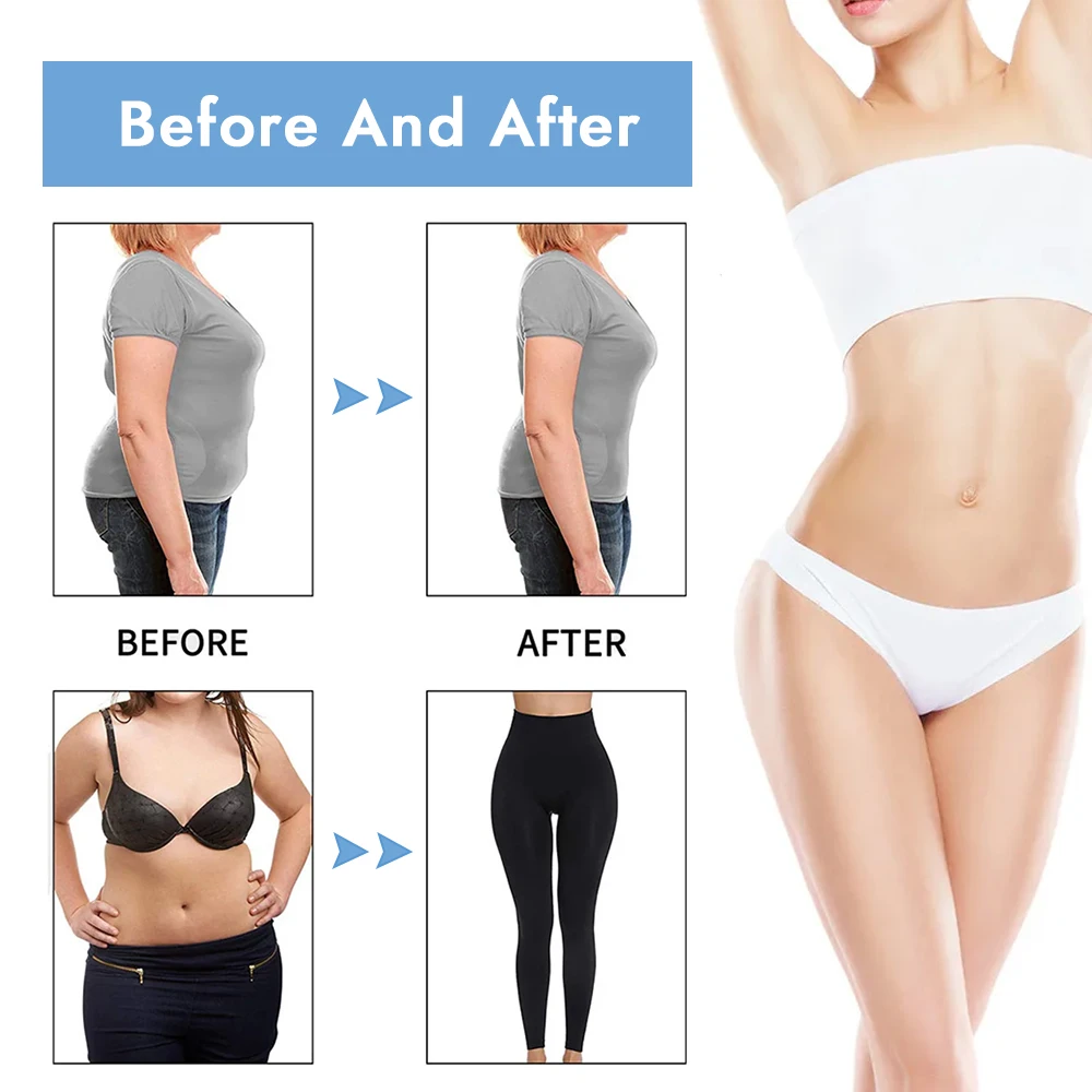 Synogal manufacturer price 360 cryo lipo suction sculpting fat loss cryolipolysis slimming machine