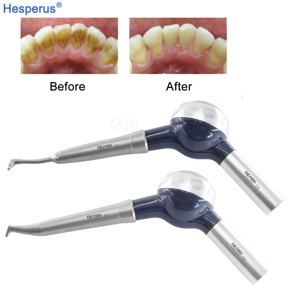 Dental Hygienist Prophy Air Flow Jet Teeth Polishing Polisher Fit For KV LUX Coupler Dental Clinic Intraoral Tools