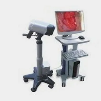 High Quality medical colposcope price Medical gynecology Medical Endoscope Vaginal Video Colposcope Price