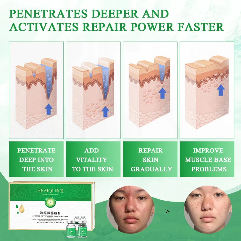 acne removal sponge spicule bio microneedling microcrystalline cellulose powder,lyophilized freeze dried powder mud mask set