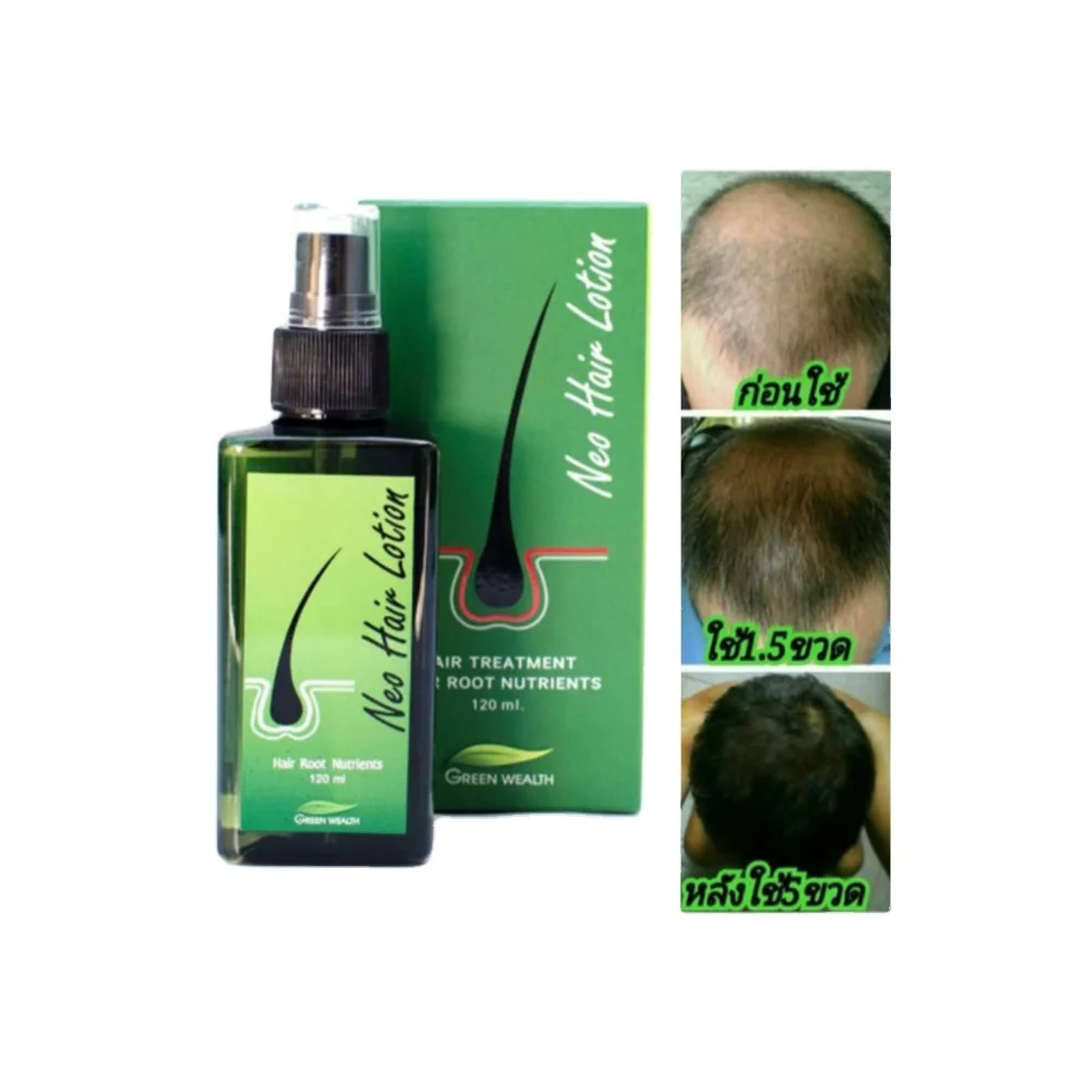 Green Wealth Top Quality Spray Stop Hair Loss Neo Hair Lotion  from Thailand