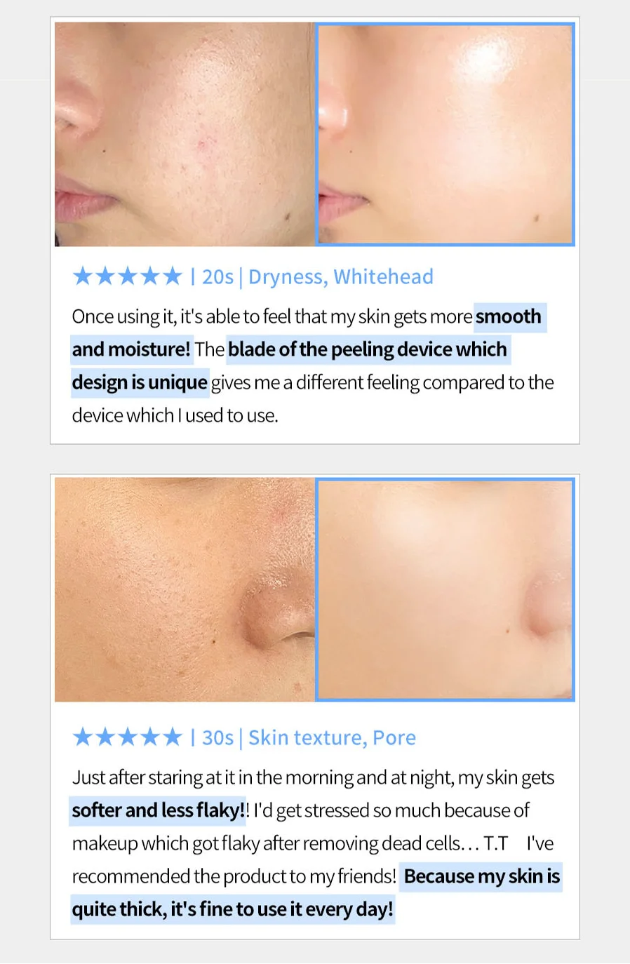 FACE FACTORY GALVANIC Z WATERPEELING MACHINE [Made in Korea/Beauty & Personal Care/USFDA/OEM/ODM/Beauty Device]