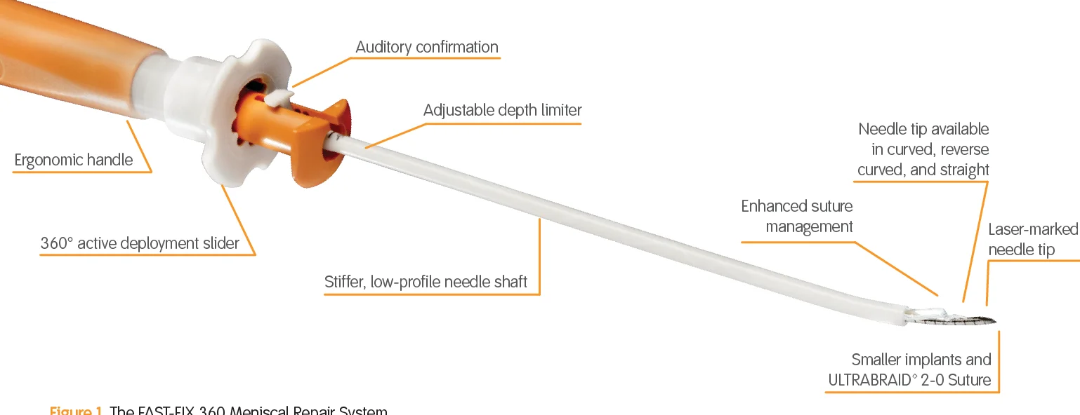 NEOSYS MENISCAL REPAIR SYSTEM - Clinically proven in the repair of meniscal tears-with a 20 year heritage of treatment success