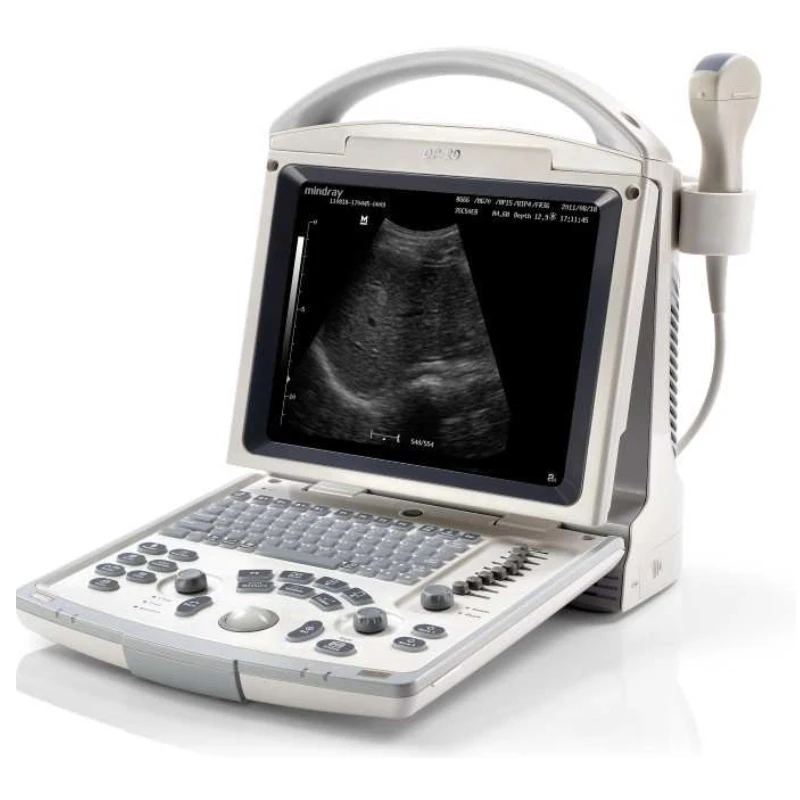 Used Mindray Digital Ultrasonic Diagnostic Imaging System DP 20 Ultrasound Machine for Human