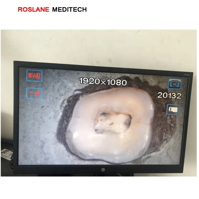 Easy to use Dental Microscope for Dental Practice