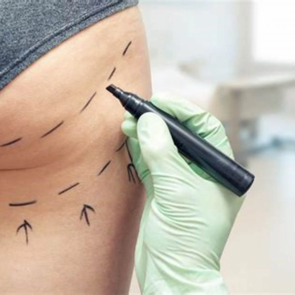 1470 diode laser minimal invasive plastic surgery endolifting laser liposuction lipo laser slimming machine