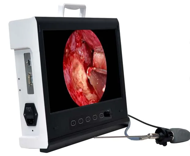 EndoscopeSIN-SED09 камера для хирургии/позвоночника/лапароскопической хирургии/гистероскопии