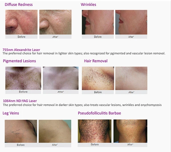 treatment before after.jpg