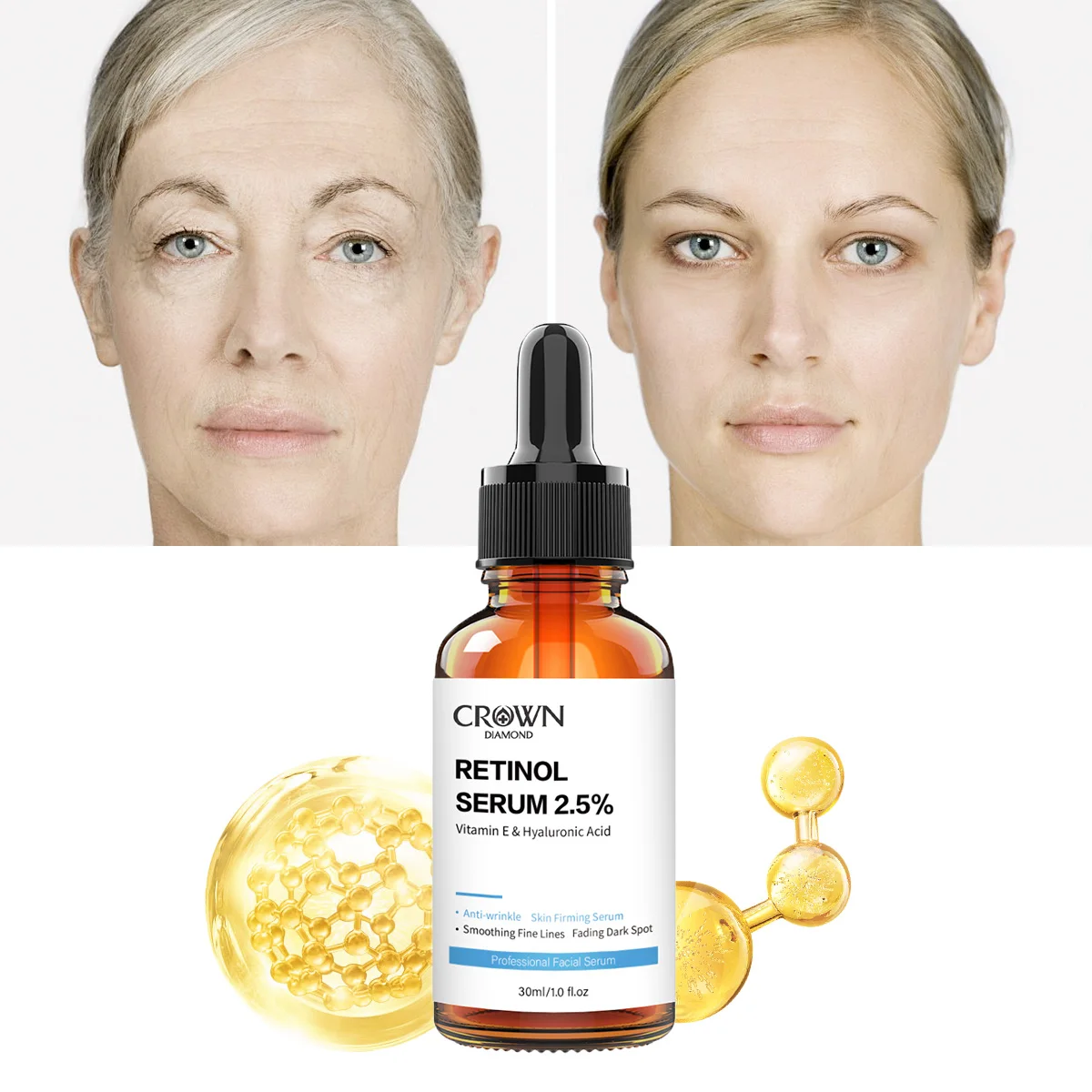 Сыворотка для лица Vitamine E Hylaroinc кислота удаления темных пятен укрепляющая Омолаживающая морщинка 2.5% ретинол сыворотка