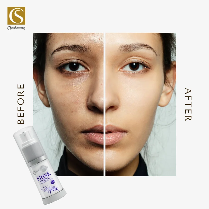 Kojic Acid Face Cream for Skin Whitening with Ferulic Acid & Vitamin E Frisk Herbal Premium Skincare Thailand Beauty Products