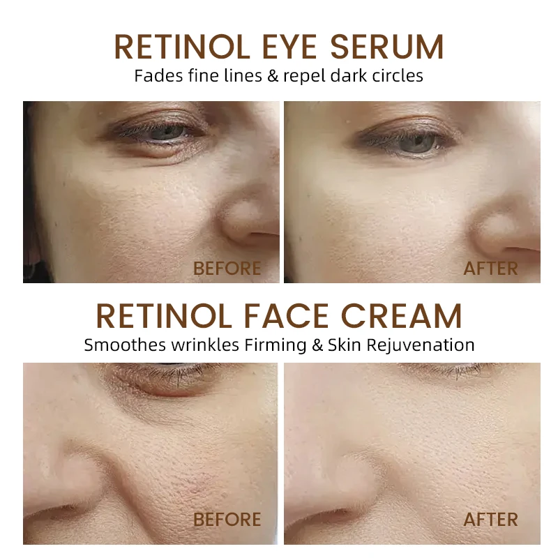 Hot Night Best Retinol Cream Vitamin C Eye Serum Skincare set contains collagen moisturizer Retinol