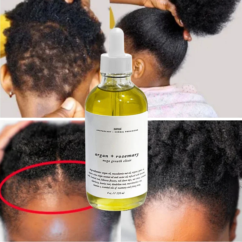 Частная Марка Natural12 травяной уход за кожей головы лечение выпадения волос эфирное масло для роста розмарин чернокожих женщин