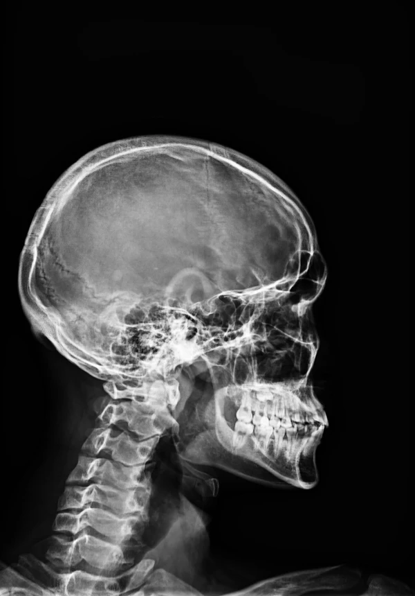 2024 Factory Price DR 17*17 inch Multi Languages Wireless Flat Panel Detector With Manual Stitching Function