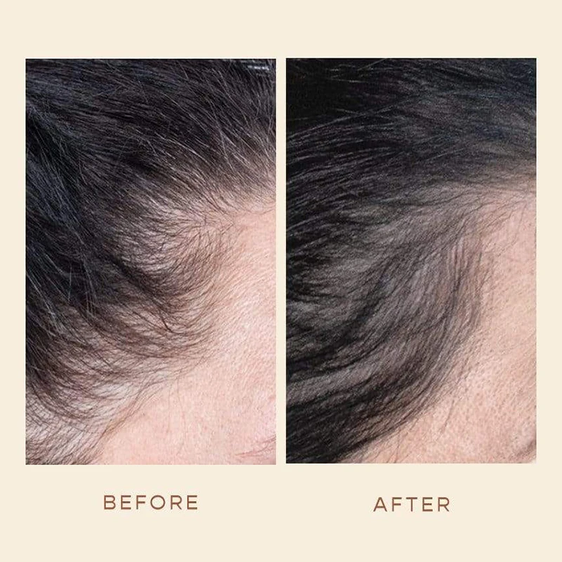 Private Label Advanced Formula Herbal Organic Nourishing Scalp Hair Growth Serum for Fast Growth