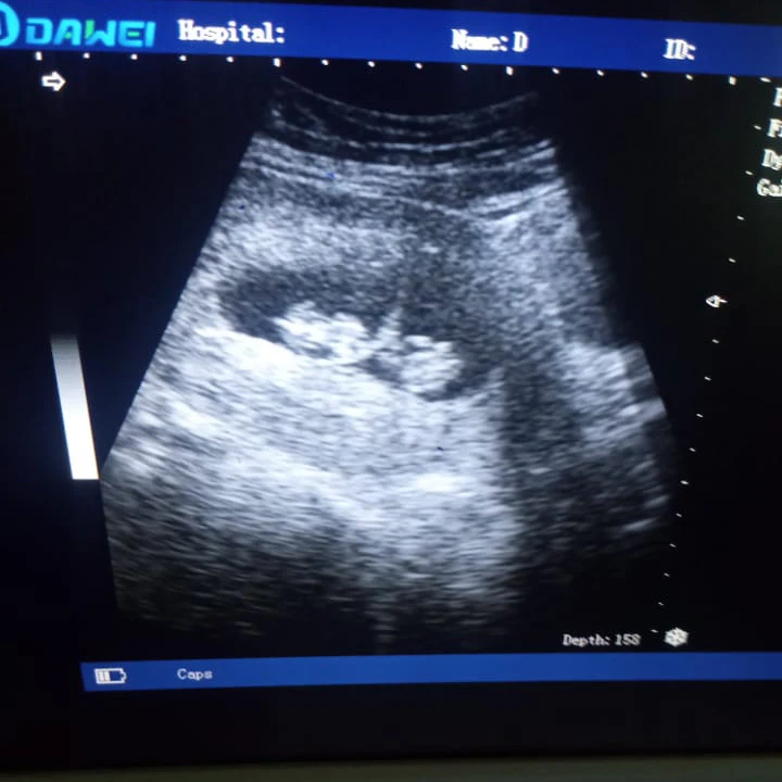 3.3MHz Wireless Convex WIFI Connected Handheld Ultrasound Machine Handheld Wireless Ultrasound Probe Portable Android IOS System