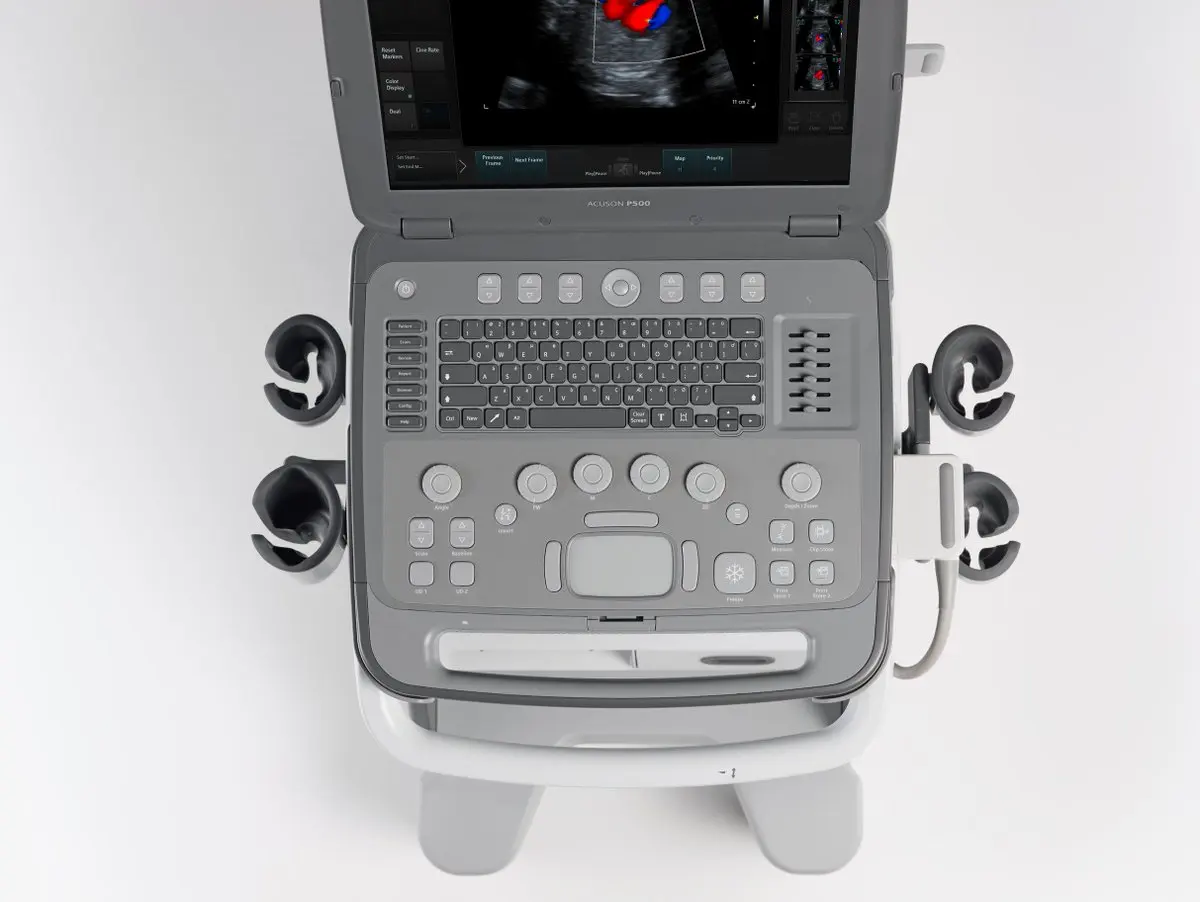 Used Medical Siemen Acuson P500 portableNot just a revolution, a revelation  This focus is what spurred the d Ultrasound machine