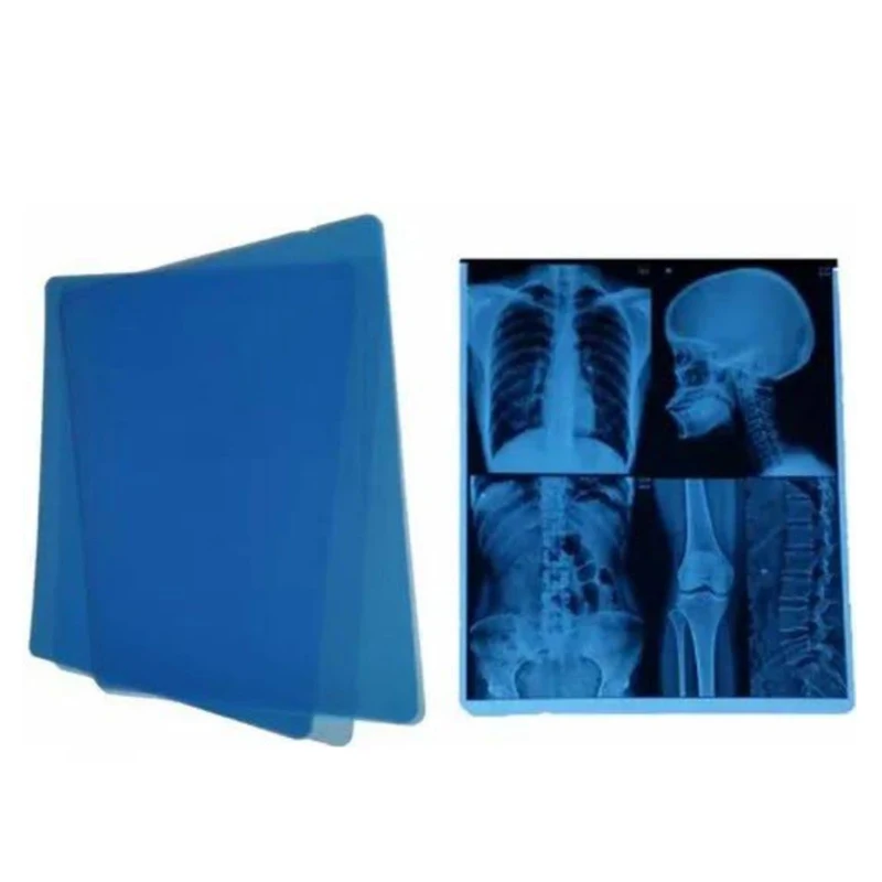 Wholesale High Definition Medical Equipment X-ray Films B5 For Medical Graphics Output